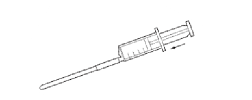 Stage 4  - Insert tube securely